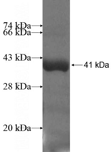 Recombinant Human SMTNL2 SDS-PAGE