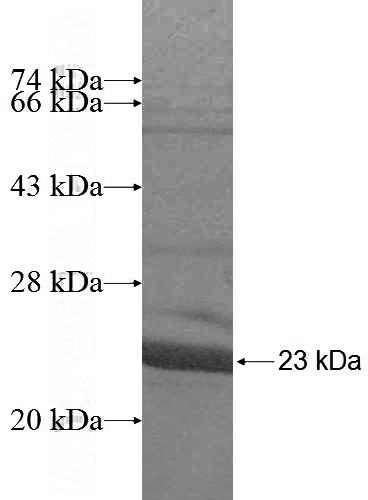 Recombinant Human DUSP23 SDS-PAGE