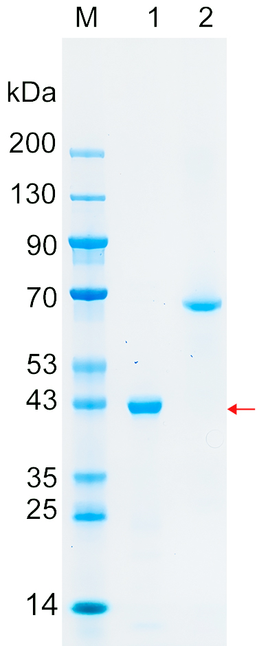 Recombinant PANK3 protein (His tag) SDS-PAGE