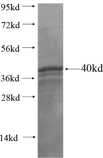 Recombinant Human DVL1 SDS-PAGE