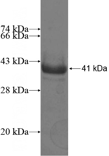 Recombinant Human CYP7A1 SDS-PAGE