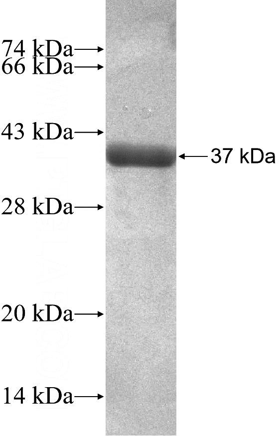 Recombinant Human SCAMP3 SDS-PAGE