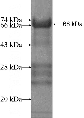 Recombinant Human MEX3B SDS-PAGE