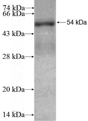 Recombinant Human Rad51D SDS-PAGE