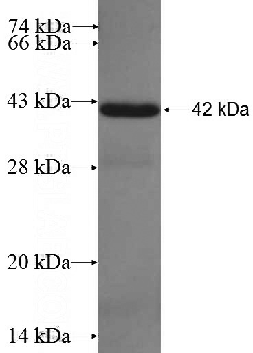 Recombinant Human CRCP SDS-PAGE