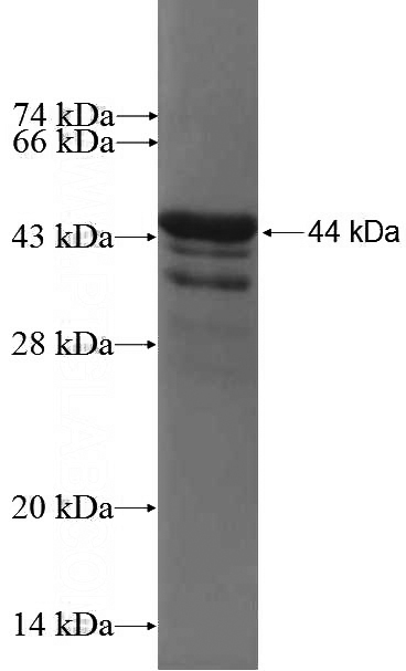 Recombinant Human PNPLA7 SDS-PAGE