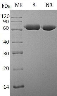 Human SGSH/HSS (His tag) recombinant protein