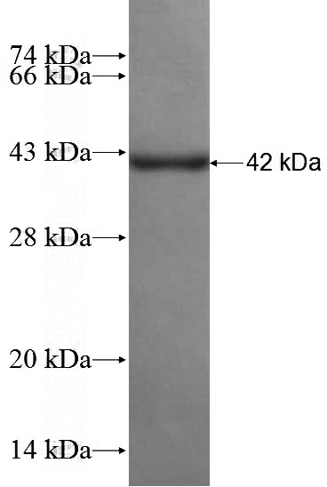 Recombinant Human PCDHB13 SDS-PAGE