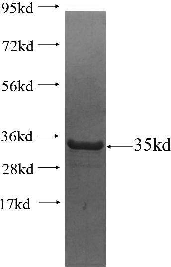 Recombinant Human RAB5C SDS-PAGE