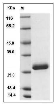 Rat Ephrin-A5 / EFNA5 Protein (His Tag) SDS-PAGE