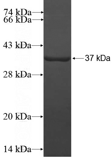 Recombinant Human TECPR1 SDS-PAGE