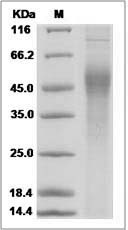 Influenza A H7N3 (A/chicken/SK/HR-00011/2007) Hemagglutinin / HA1 Protein (His Tag)