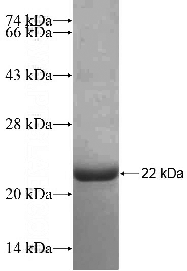 Recombinant Human GJC1 SDS-PAGE