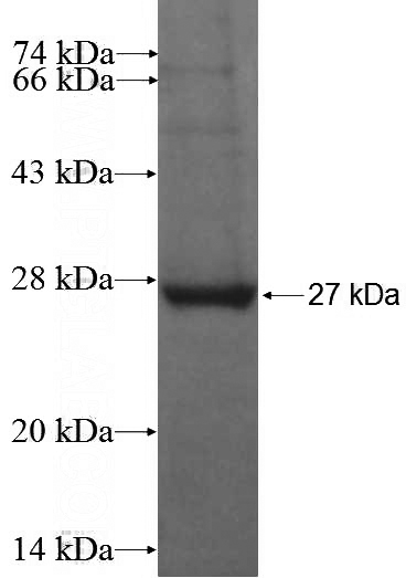 Recombinant Human RAB25 SDS-PAGE
