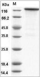 Human / Rhesus HER4 / ErbB4 Protein (Fc Tag) SDS-PAGE