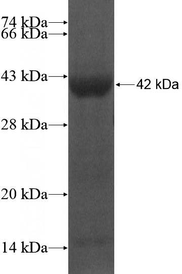 Recombinant Human AIM1 SDS-PAGE