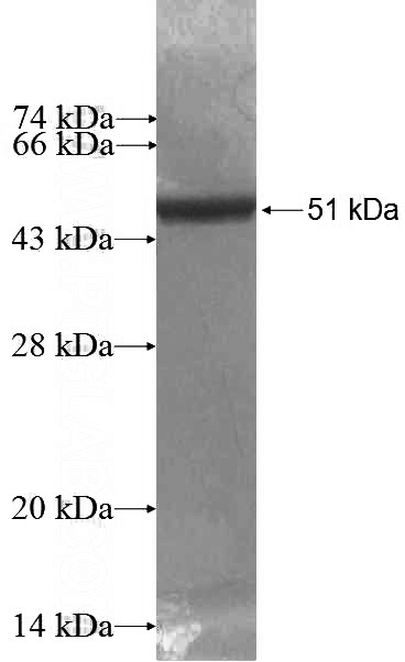 Recombinant Human RAB39B SDS-PAGE