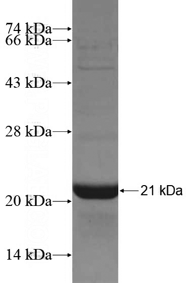 Recombinant Human TUSC3 SDS-PAGE