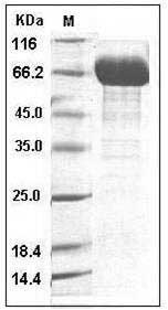 Human IL12B / P40 Protein (Fc Tag) SDS-PAGE