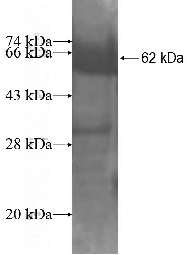 Recombinant Human AP3B1 SDS-PAGE