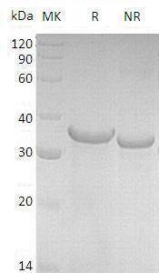 Human NRG1/GGF/HGL/HRGA/NDF/SMDF recombinant protein