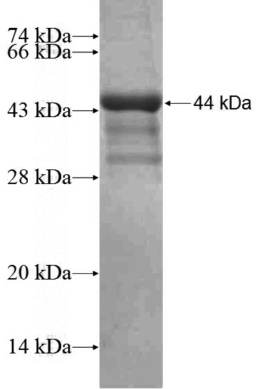 Recombinant Human CLCN2 SDS-PAGE