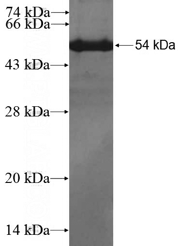 Recombinant Human RDH10 SDS-PAGE