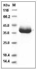 Mouse SFRP1 (His Tag) recombinant protein