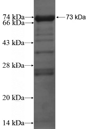 Recombinant Human HORMAD1 SDS-PAGE