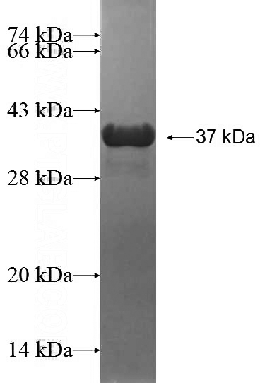 Recombinant Human PSMD9 SDS-PAGE