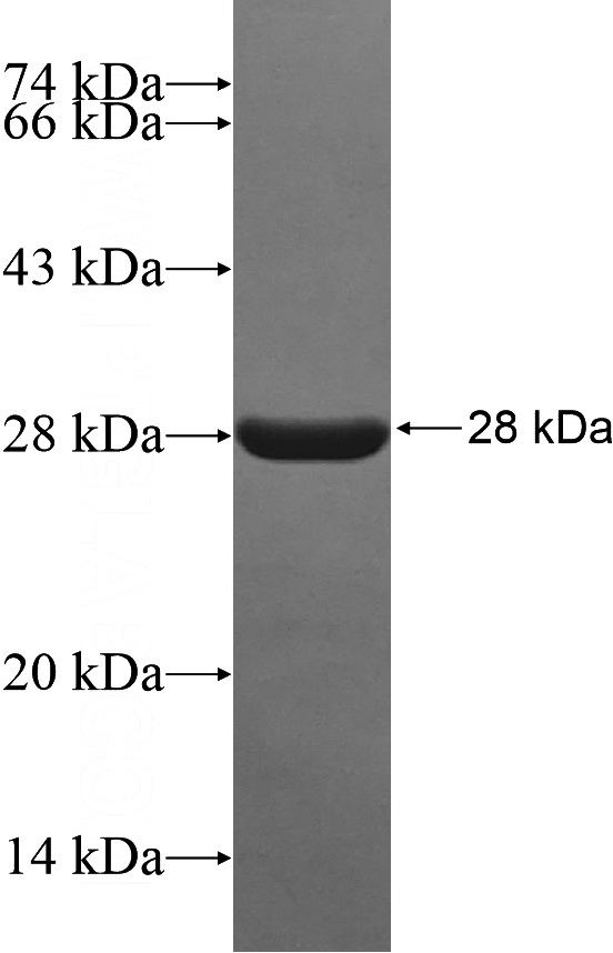 Recombinant Human MAP1B SDS-PAGE