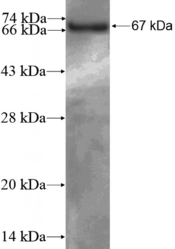 Recombinant Human ATF7IP2 SDS-PAGE