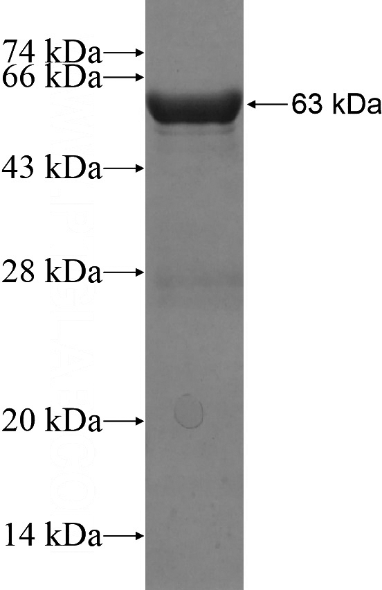 Recombinant Human LIMS1 SDS-PAGE