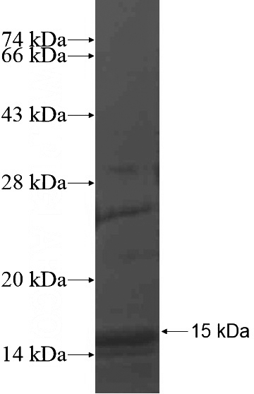 Recombinant Human SLC16A6 SDS-PAGE