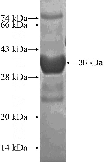 Recombinant Human DPPA5 SDS-PAGE
