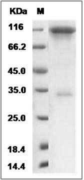 Rat HER3 / ErbB3 Protein (Fc Tag) SDS-PAGE