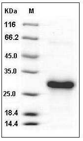 Human CLEC4A / CLECSF6 / DCIR Protein (His Tag) SDS-PAGE