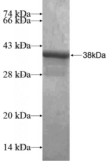 Recombinant Human CACNA2D1 SDS-PAGE