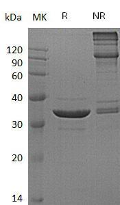 Human ACYP2/ACYP (GST tag) recombinant protein