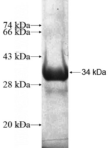 Recombinant Human ACSBG2 SDS-PAGE