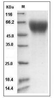 Mouse IL17RA / IL17R / CD217 Protein (His Tag) SDS-PAGE
