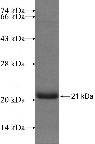 Recombinant Human RECQL4 SDS-PAGE
