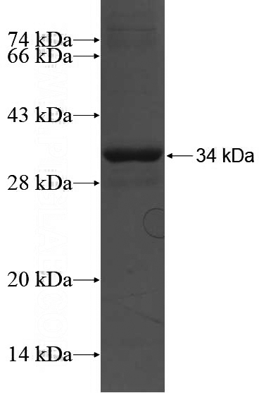 Recombinant Human EIF3E SDS-PAGE