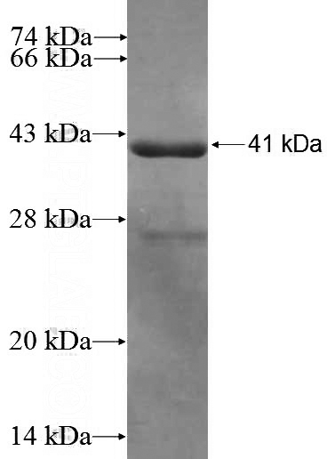 Recombinant Human SELENBP1 SDS-PAGE