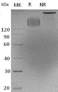 Human CEACAM5/CEA (Fc tag) recombinant protein