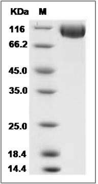 Cynomolgus DPP4 / DPPIV / CD26 Protein SDS-PAGE