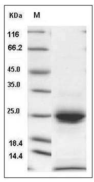 Human KLK6 / Kallikrein 6 / Neurosin Protein (His Tag) SDS-PAGE