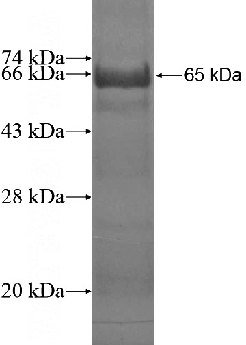 Recombinant Human MRI1 SDS-PAGE