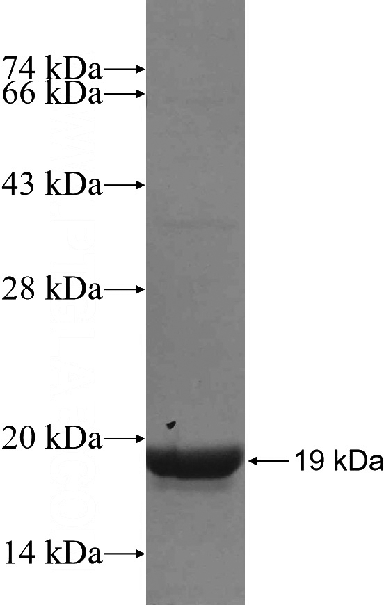 Recombinant Human KIF5B SDS-PAGE
