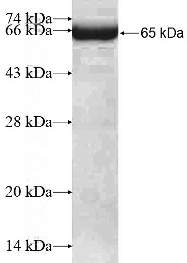 Recombinant Human HUWE1 SDS-PAGE